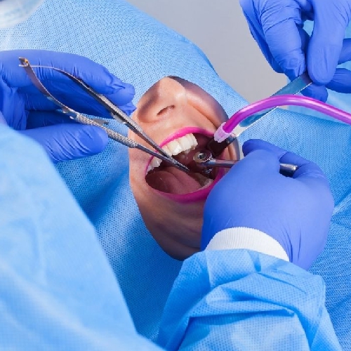 Cirugía Bucal y Maxilofacial 1