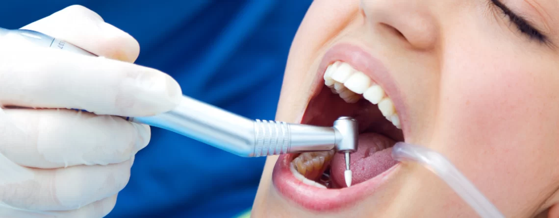 Limpieza dental