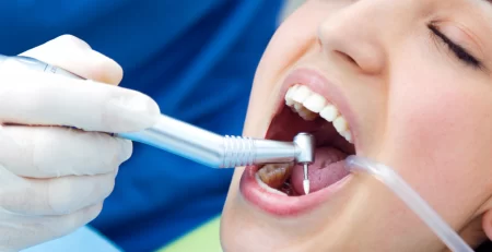 Limpieza dental