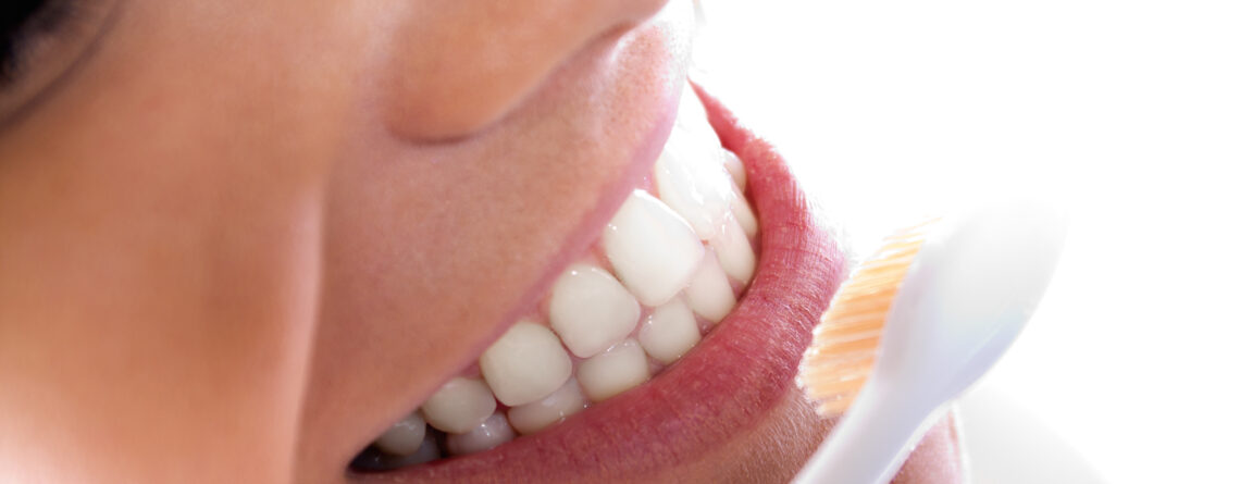 estética dental en Comas