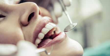 LIMPIEZA DENTAL