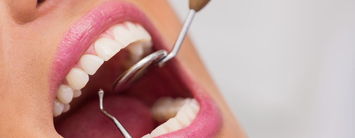 limpieza dental