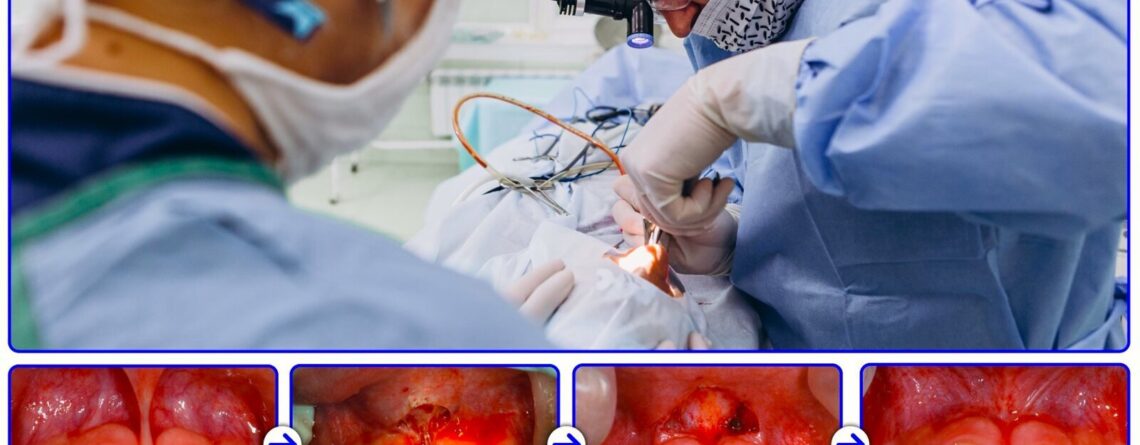 cirugia bucal
