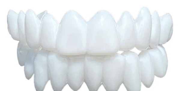 carillas dentales