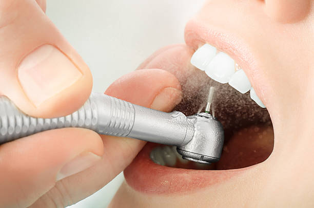 Profilaxis Dental