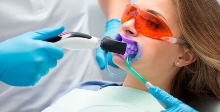 blanqueamiento dental