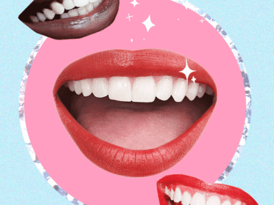 BLANCAMIENTO DENTAL