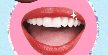 BLANCAMIENTO DENTAL