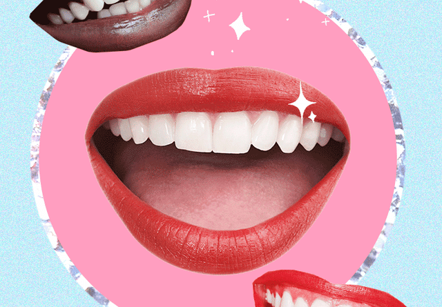 BLANCAMIENTO DENTAL