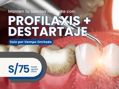 profilaxis denta