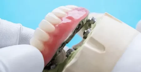 protesis dental removibles